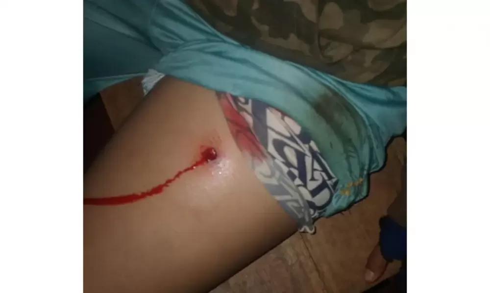 O povo avá-guarani da Terra Indígena (TI) Tekoha Guasu Guavirá, localizada entre Guaíra e Terra Roxa, no oeste do Paraná, voltou a sofrer ataques durante a noite dessa sexta-feira (3). Quatro indígenas ficaram feridos e precisaram ser encaminhados ao hosp