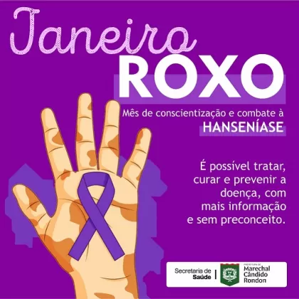 (Foto: Divulgação)