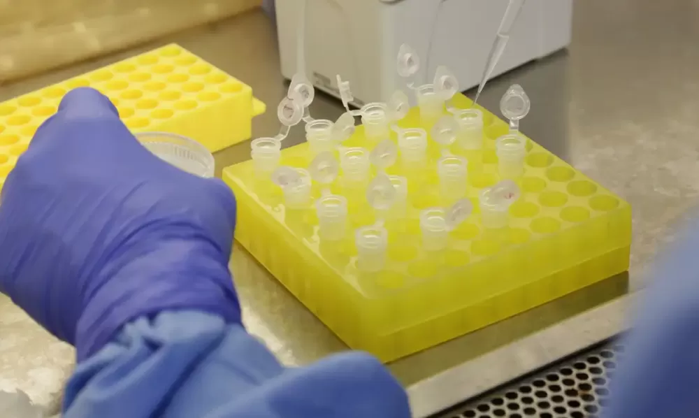  Divulgação/Josué Damacena (IOC/Fiocruz)