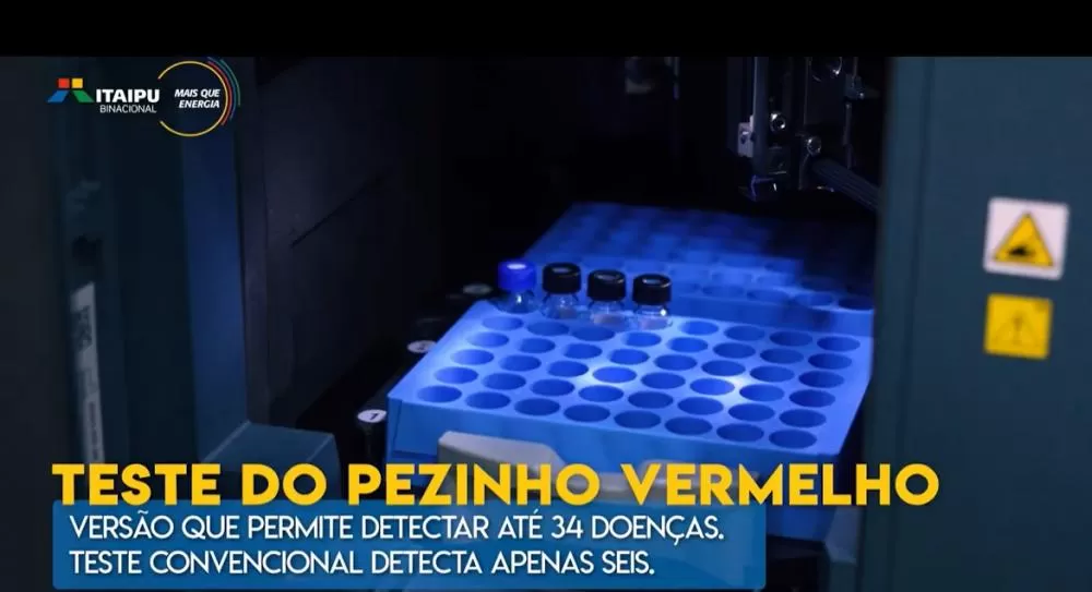 Teste do pezinho ampliado beneficia 500 recém-nascidos por mês