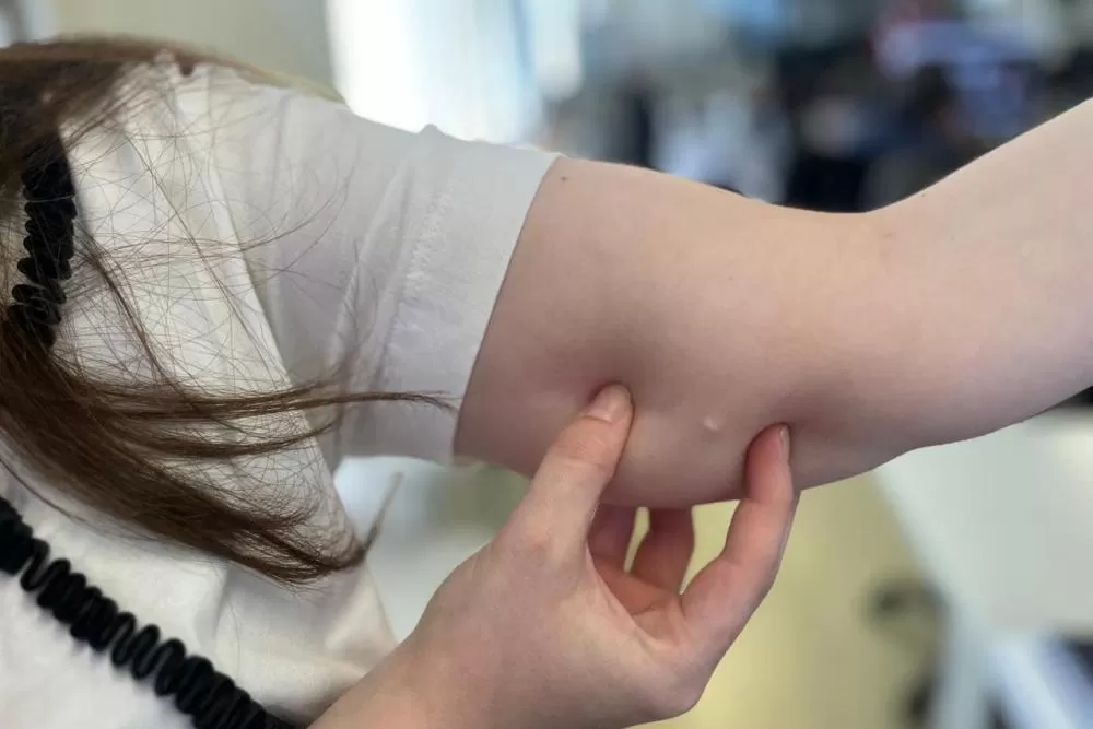 Procura por implante contraceptivo cresce 118% no SUS do Paraná em 2025 Foto: SESA