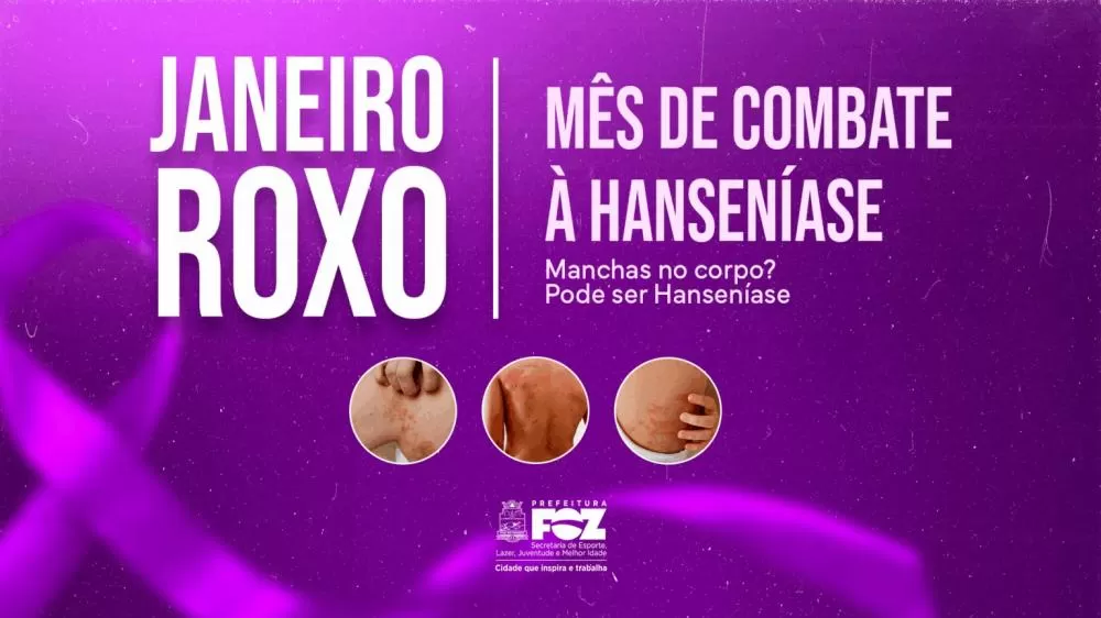 Janeiro Roxo: informação, cuidado e combate ao estigma da hanseníase