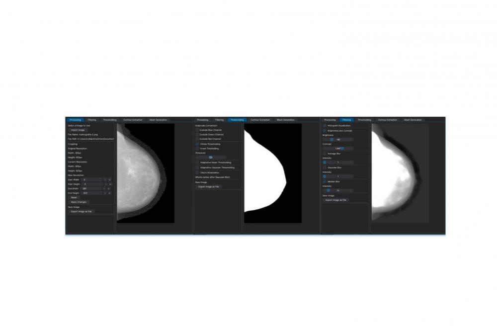 Software desenvolvido na UEL avalia progressão e tratamento do câncer de mama Foto: UEL