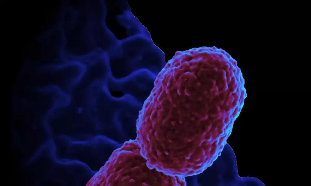 © NIAID/Direitos Reservados