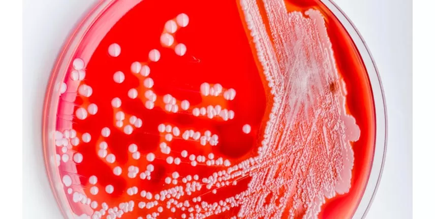 Infecção rara e fatal registra aumento alarmante sem causa definida © Shutterstock