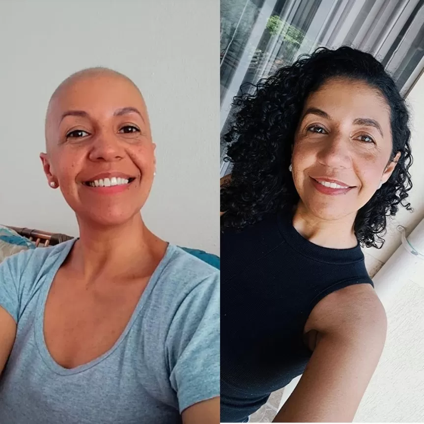  Antes e depois: a professora Valquíria Correa, de 46 anos, descobriu um nódulo por um autoexame confirmado com uma mamografia e passou pelo tratamento da quimio e radioterapia.Créditos: Divulgação/Assessoria Parlamentar